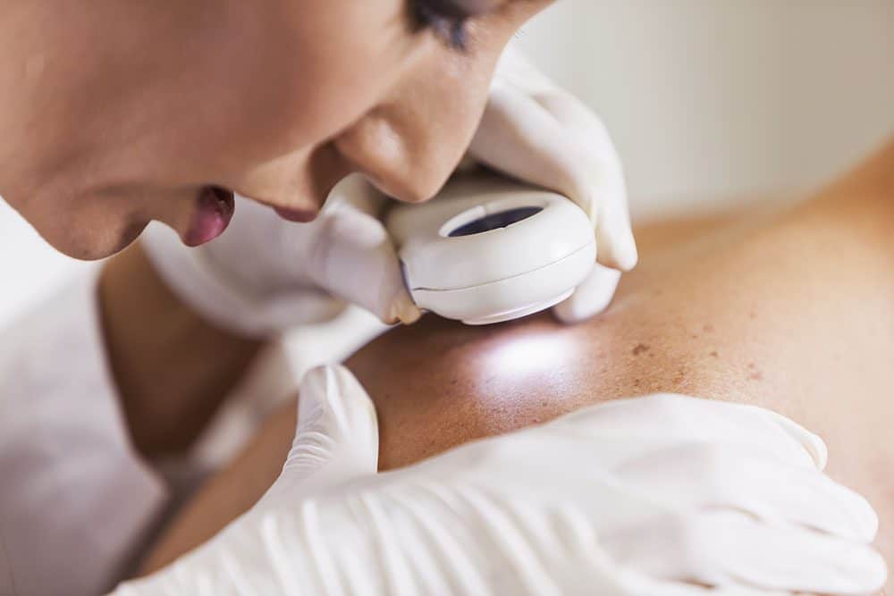 Skin Cancer Treatment Sarasota FL