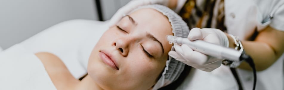 Microneedling Sarasota FL