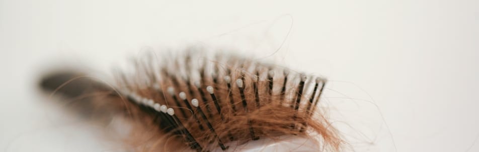 Hair Loss Treatment Sarasota FL