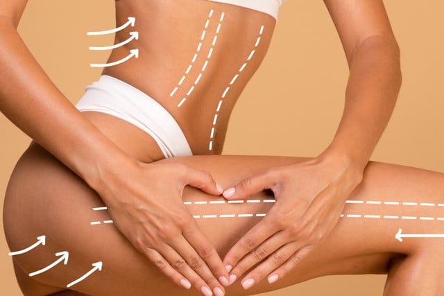 woman with massage lines and arrows on her body touching skin on leg