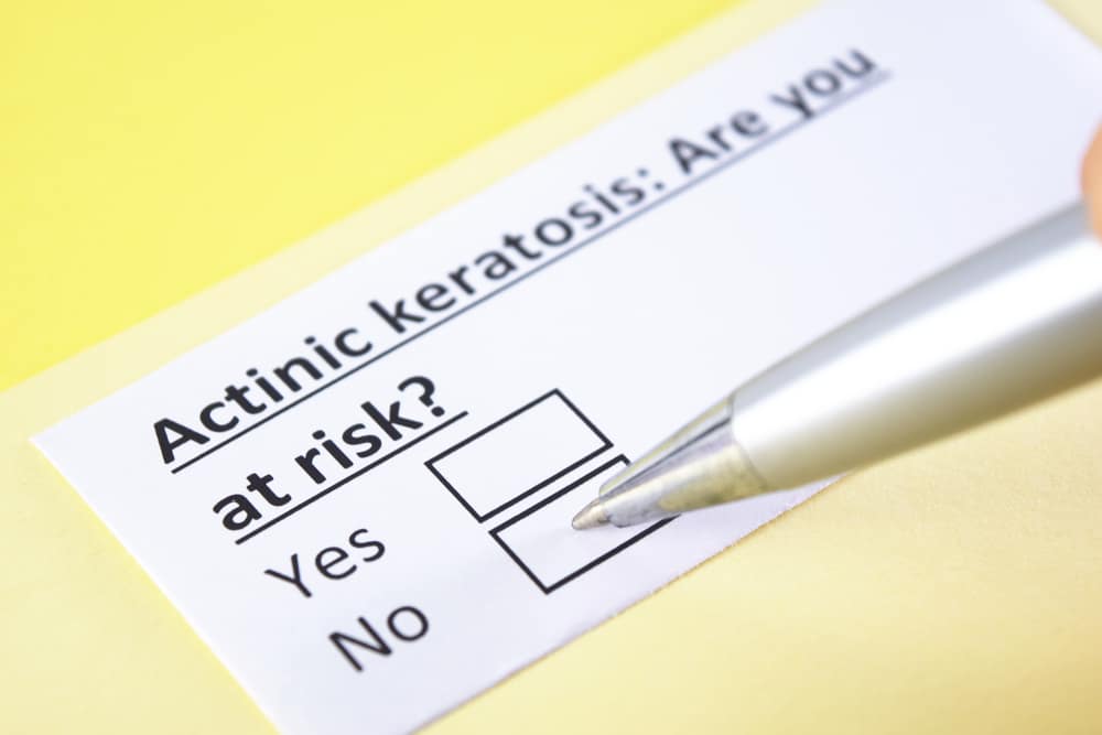 Actinic Keratosis Sarasota FL