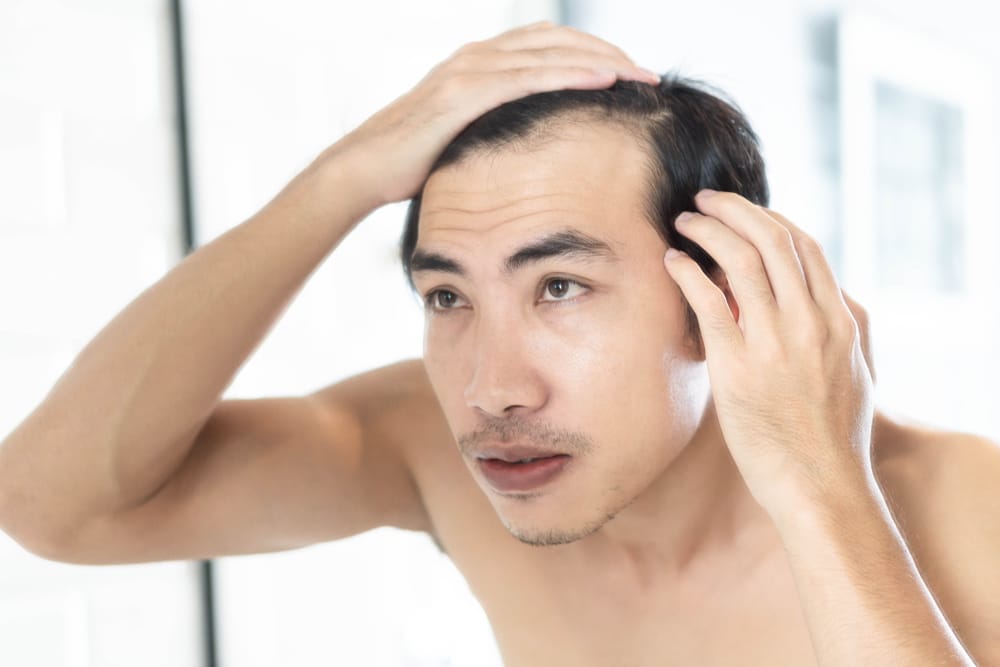 Hair Loss Sarasota FL