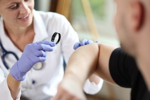 Doctor uses a magnifying glass to examine an irregularity on male patient's skin.